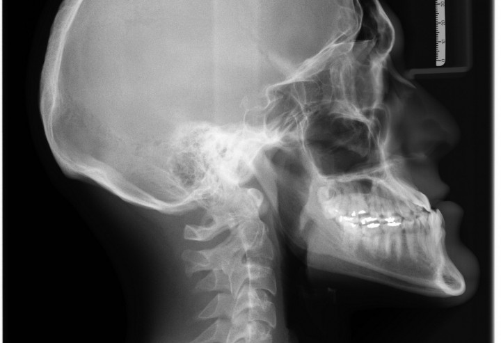 Strahlenschutz in Medizin und Technik